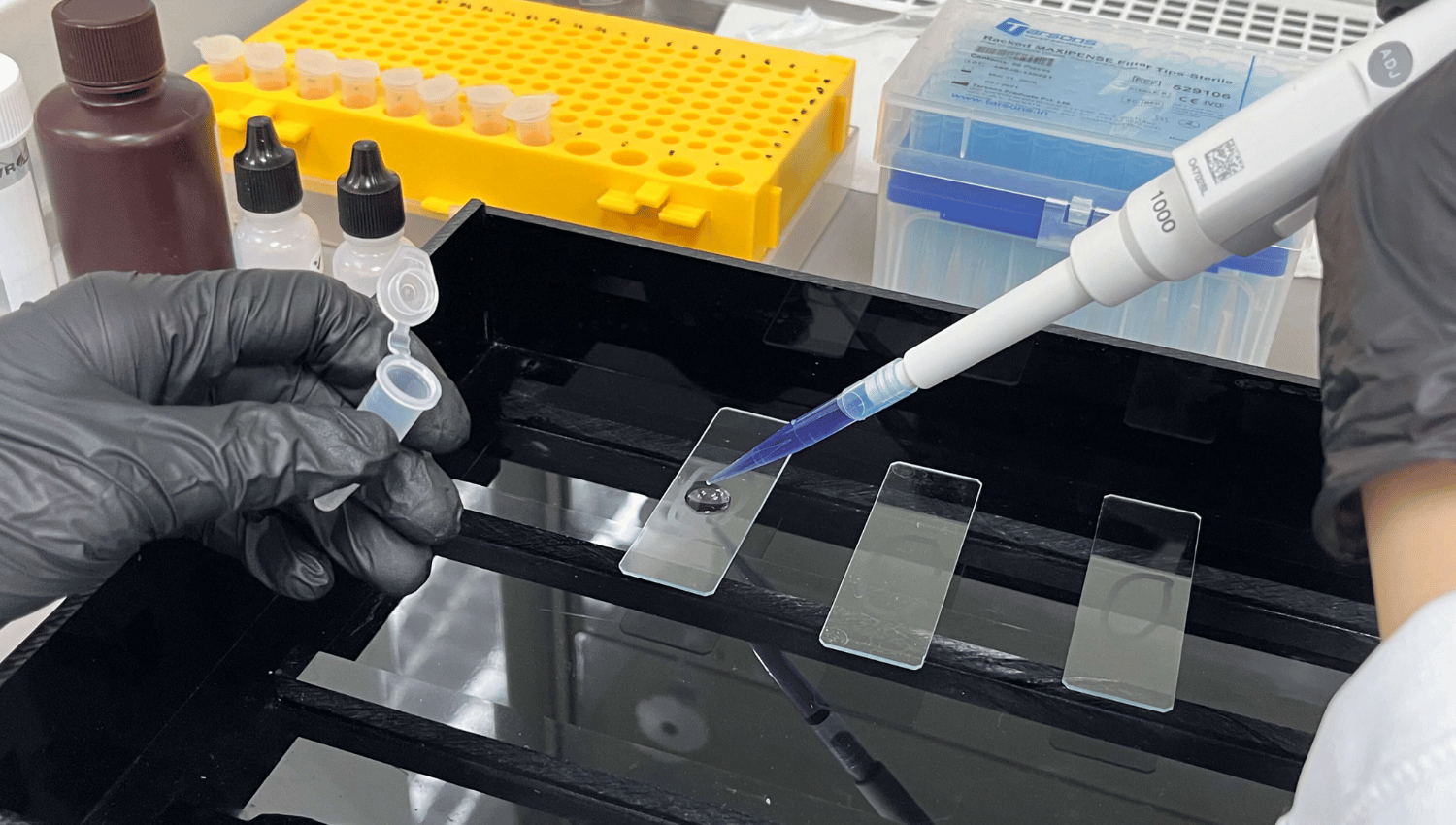 Histopathology Staining Explained H&E and IHC Staining