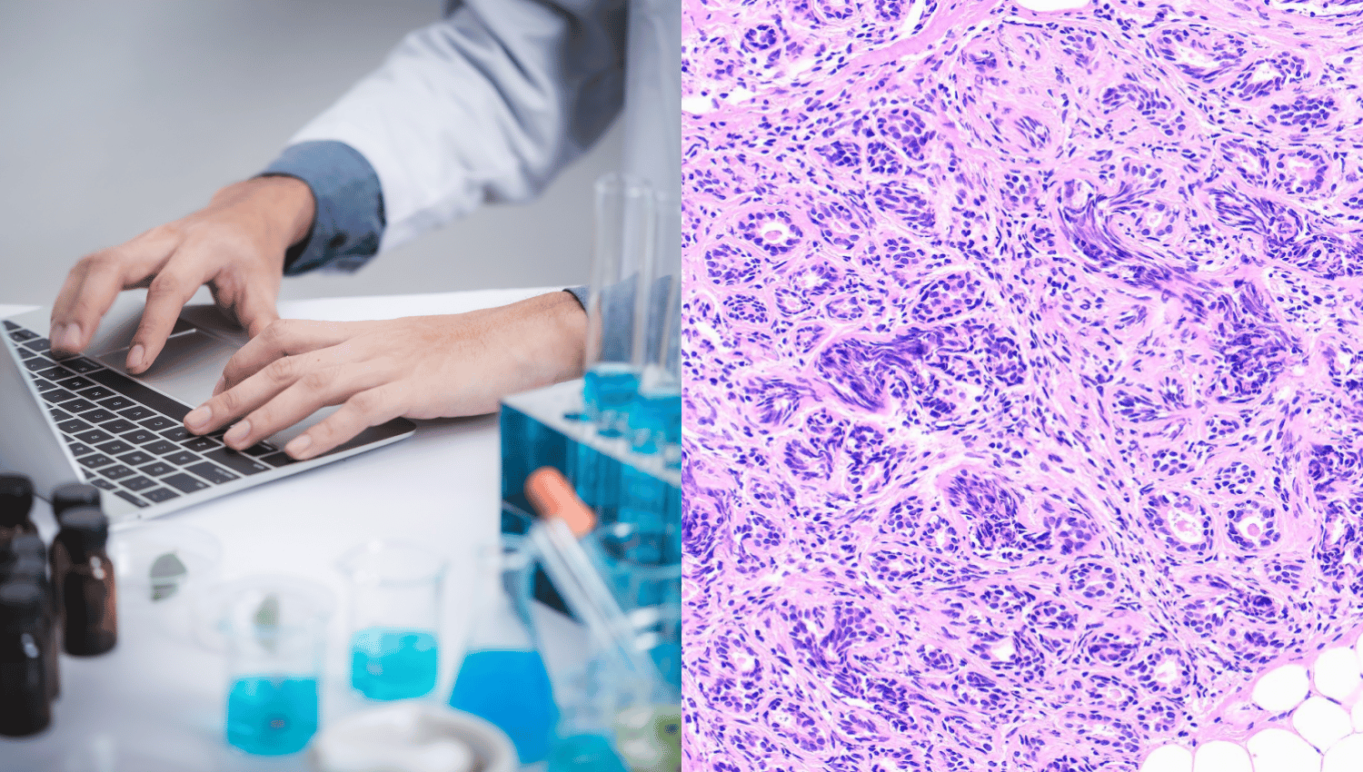 Tissue Microarray for Clinical Research_